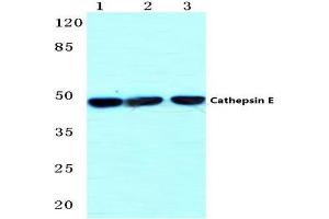Western blot (WB) analysis of Cathepsin E antibody  at 1/500 dilution. (Cathepsin E antibody)