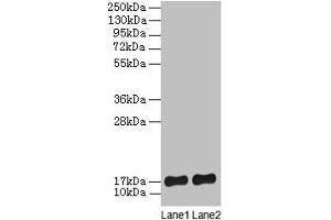 Western blot All lanes: SRP19 antibody at 2 μg/mL Lane 1: Jurkat whole cell lysate Lane 2: Hela whole cell lysate Secondary Goat polyclonal to rabbit lgG at 1/15000 dilution Predicted band size: 17, 13, 9 kDa Observed band size: 17 kDa (SRP19 antibody  (AA 2-144))