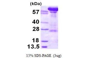 SDS-PAGE (SDS) image for Karyopherin (Importin) beta 1 (KPNB1) (AA 1-876) protein (His tag) (ABIN667986)