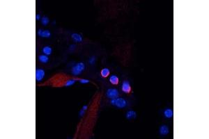 anti-Potassium Voltage-Gated Channel, KQT-Like Subfamily, Member 4 (KCNQ4) (AA 2-77) antibody