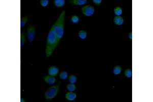 IF analysis of Serum Amyloid P/APCS using anti-Serum Amyloid P/APCS antibody (ABIN5693182). (APCS antibody  (AA 20-220))