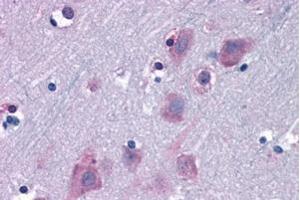 ABIN184974 (6. (TRIM2 antibody  (C-Term))