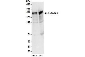 anti-Regulation of Nuclear Pre-mRNA Domain Containing 2 (RPRD2) (AA 1000-1050) antibody