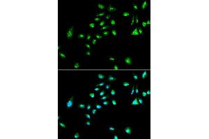 Immunofluorescence analysis of A549 cell using RAF1 antibody. (RAF1 antibody  (AA 190-350))