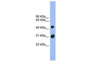 Image no. 1 for anti-LIM Homeobox 5 (LHX5) (AA 251-300) antibody (ABIN6744536) (LHX5 antibody  (AA 251-300))