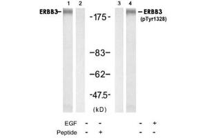 Western blot analysis of extracts from HUVEC cell using ERBB3 polyclonal antibody (Cat # PAB12231, Lane 1 and 2) and Phospho-ERBB3 Y1328 polyclonal antibody (Cat # PAB12186, Lane 3 and 4). (ERBB3 antibody  (Tyr1328))