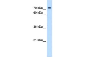 Western Blotting (WB) image for anti-Solute Carrier Family 5 (Sodium/inositol Cotransporter), Member 11 (SLC5A11) antibody (ABIN2462773) (Solute Carrier Family 5 (Sodium/inositol Cotransporter), Member 11 (SLC5A11) antibody)