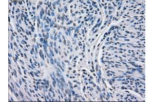 Immunohistochemical staining of paraffin-embedded endometrium tissue using anti-BCKDK mouse monoclonal antibody. (BCKDK antibody)