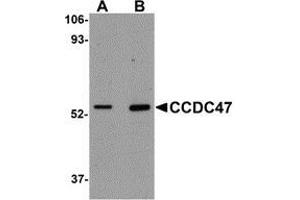 Western blot analysis of CCDC47 in mouse heart tissue lysate with AP30211PU-N CCDC47 antibody at (A) 1 and (B) 2 μg/ml. (CCDC47 antibody  (C-Term))