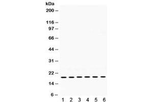 Western blot testing of 1) rat skeletal muscle, 2) rat thymus, 3) mouse brain, 4) mouse thymus, 5) human 22RV1, and 6) human MCF7 lysate with PTP4A2 antibody.