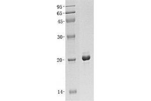 Validation with Western Blot (MAX Protein (Transcript Variant 1) (His tag))