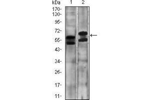Western blot analysis using CA9 mouse mAb against A431 (1) and SW620 (2) cell lysate.