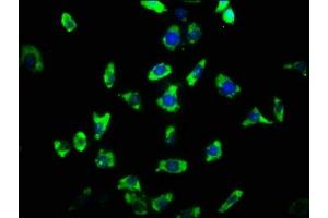 Immunofluorescence staining of SH-SY5Y cells with ABIN7167956 at 1:33, counter-stained with DAPI. (ARHGAP32 antibody  (AA 130-205))