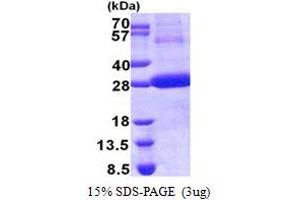 SDS-PAGE (SDS) image for Cathepsin F (CTSF) (AA 271-484) protein (His tag) (ABIN5853153)