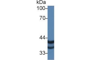 Western blot analysis of Human A375 cell lysate, using Human PSG2 Antibody (1 µg/ml) and HRP-conjugated Goat Anti-Rabbit antibody ( (PSG2 antibody  (AA 35-335))