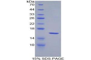 SDS-PAGE analysis of Mouse IL18R1 Protein.