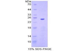 SDS-PAGE analysis of Mouse Sprouty Homolog 3 Protein. (SPRY3 Protein)