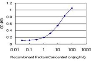 Detection limit for recombinant GST tagged LIMK1 is approximately 0. (LIM Domain Kinase 1 antibody  (AA 548-647))