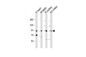 All lanes : Anti-PDE1C Antibody (Center) at 1:1000-2000 dilution Lane 1: human heart lysate Lane 2: mouse testis lysate Lane 3: rat kidney lysate Lane 4: NCI- whole cell lysate Lysates/proteins at 20 μg per lane.