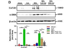 Calcipotriol alleviates BDL-induced liver injury and fibrosis. (COL1A1 antibody  (AA 100-200))
