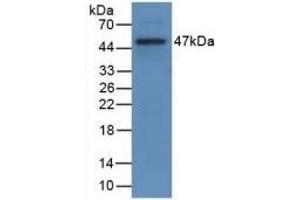 Detection of Recombinant CD40L, Rat using Monoclonal Antibody to Cluster Of Differentiation 40 Ligand (CD40L) (CD40 Ligand antibody  (AA 105-260))