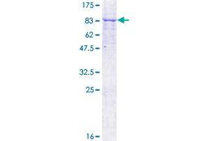 MKKS Protein (AA 1-570) (GST tag)