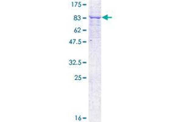 MKKS Protein (AA 1-570) (GST tag)