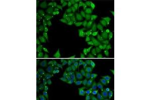 Immunofluorescence analysis of MCF7 cells using RTKN Polyclonal Antibody (Rhotekin antibody)