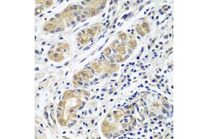 Immunohistochemistry of paraffin-embedded human stomach using GPRC5A antibody (ABIN5974510) at dilution of 1/100 (40x lens). (GPRC5A antibody)