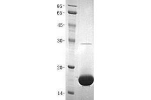 Small Ubiquitin Related Modifier 2 (SUMO2) (Transcript Variant 2) protein (His tag)