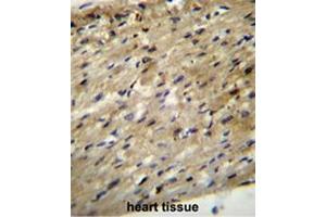 ABCD2 Antibody (C-term) immunohistochemistry analysis in formalin fixed and paraffin embedded human heart tissue followed by peroxidase conjugation of the secondary antibody and DAB staining. (Abcd2 antibody  (C-Term))