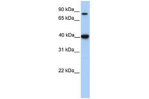 ACAT1 antibody used at 1 ug/ml to detect target protein. (ACAT1 antibody)