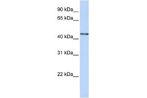 B3GNT4 antibody used at 1 ug/ml to detect target protein. (B3GNT4 antibody  (N-Term))