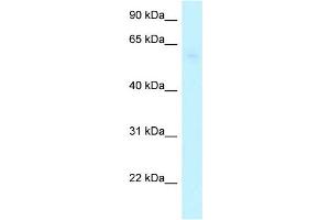 WB Suggested Anti-ARHGAP28 Antibody Titration: 1. (ARHGAP28 antibody  (C-Term))