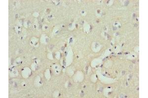 Immunohistochemistry of paraffin-embedded human brain tissue using ABIN7176132 at dilution of 1:100 (ZNF177 antibody  (AA 1-321))