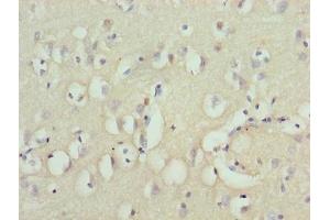 Immunohistochemistry of paraffin-embedded human brain tissue using ABIN7176132 at dilution of 1:100