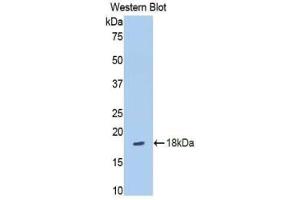 Western blot analysis of the recombinant protein. (SLIT3 antibody  (AA 35-119))