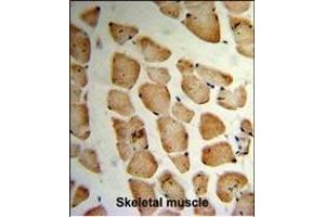 Formalin-fixed and paraffin-embedded human Skeletal muscle reacted with MVD Antibody (N-term), which was peroxidase-conjugated to the secondary antibody, followed by DAB staining.