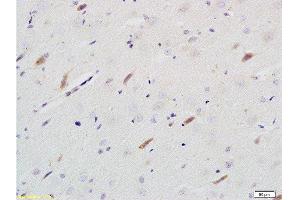 Formalin-fixed and paraffin embedded rat brain tissue labeled with Rabbit Anti-Neuroligin 1 Polyclonal Antibody  at 1:200 followed by conjugation to the secondary antibody and DAB staining. (Neuroligin 1 antibody  (AA 701-800))
