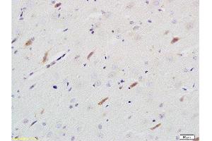 Formalin-fixed and paraffin embedded rat brain tissue labeled with Rabbit Anti-Neuroligin 1 Polyclonal Antibody  at 1:200 followed by conjugation to the secondary antibody and DAB staining. (Neuroligin 1 antibody  (AA 701-800))