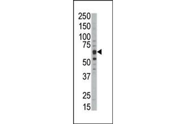 DYRK1B antibody  (C-Term)