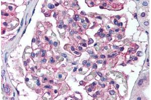 Human Kidney (formalin-fixed, paraffin-embedded) stained with PTK2B antibody ABIN239840 at 1:50 followed by biotinylated goat anti-rabbit IgG secondary antibody ABIN481713, alkaline phosphatase-streptavidin and chromogen. (PTK2B antibody  (N-Term))