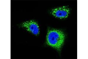 Confocal immunofluorescent analysis of TrkA antibody with MDA-MB231 cells followed by Alexa Fluor 488-conjugated goat anti-rabbit lgG (green). (TRKA antibody)