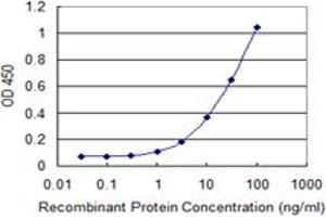 Detection limit for recombinant GST tagged STIM1 is 0. (STIM1 antibody  (AA 24-685))