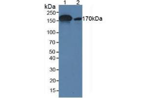 Figure. (alpha 2 Macroglobulin antibody  (AA 616-856))