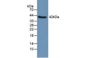 Western blot analysis of Human Uterus. (QPCT antibody  (AA 29-361))