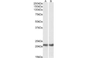ABIN238599 (0. (CRYAB antibody  (Internal Region))