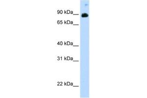 Western Blotting (WB) image for anti-Signal Transducer and Activator of Transcription 6, Interleukin-4 Induced (STAT6) antibody (ABIN2461683) (STAT6 antibody)