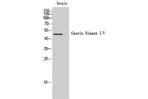 Western Blotting (WB) image for anti-Casein Kinase 1, delta (CSNK1D) (Internal Region) antibody (ABIN3183662) (Casein Kinase 1 delta antibody  (Internal Region))