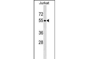 PN Antibody (C-term) (ABIN1537241 and ABIN2849414) western blot analysis in Jurkat cell line lysates (35 μg/lane). (PNMA3 antibody  (C-Term))
